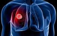 καρκίνος πνεύμονα: μεγαλύτερη επιβίωση για τους χειρουργημένους ηλικιωμένους ασθενείς (doc)