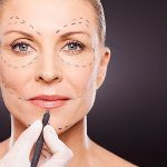 plastic-surgery-660